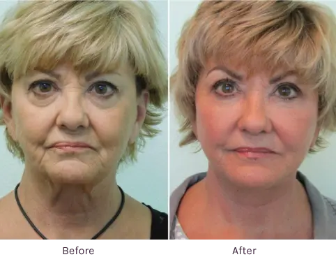 Lanfranchi_Gallery-Case-1 | The Lafranchi Center