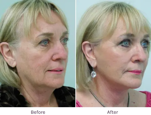 Lanfranchi_Gallery-Case-2 | The Lafranchi Center