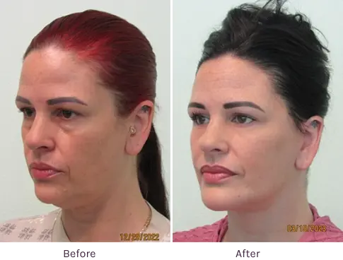 Lanfranchi_Gallery-Case-4 | The Lafranchi Center