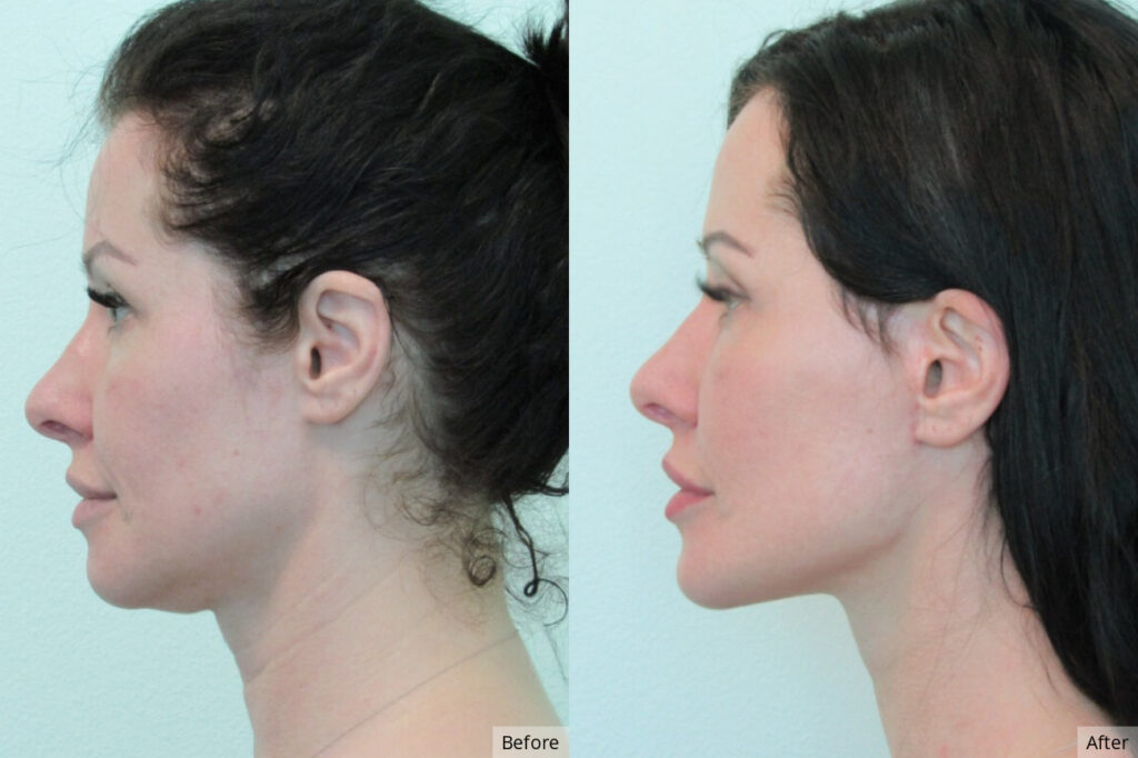 2991726557597 | The Lafranchi Center